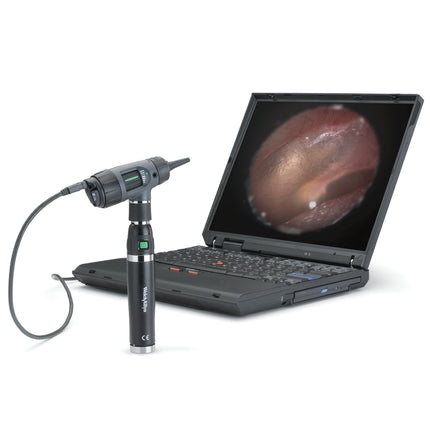 Otoscopio Digital MacroView USB con Cable | Welch Allyn